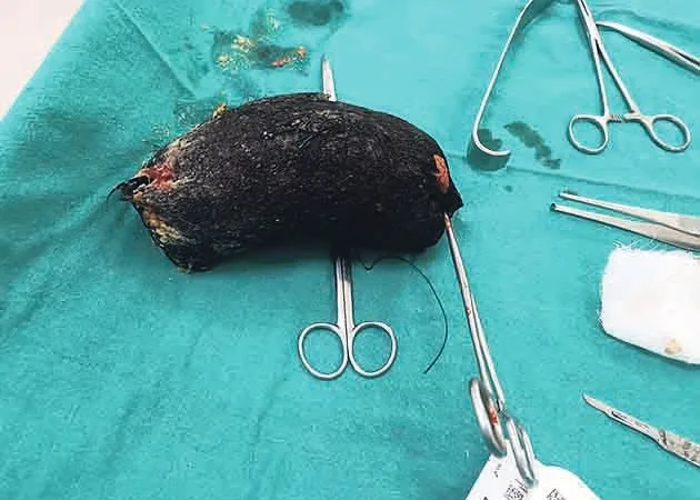 236 1753976557688b8eed7ac6f 06.jpg