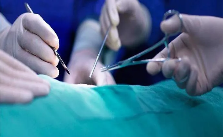 laparoscopic appendix removal surgery 1754381057.jpeg