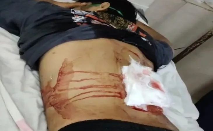 whatsapp image 2025 08 05 at 083135 fotor 20250805 1754362996.jpg